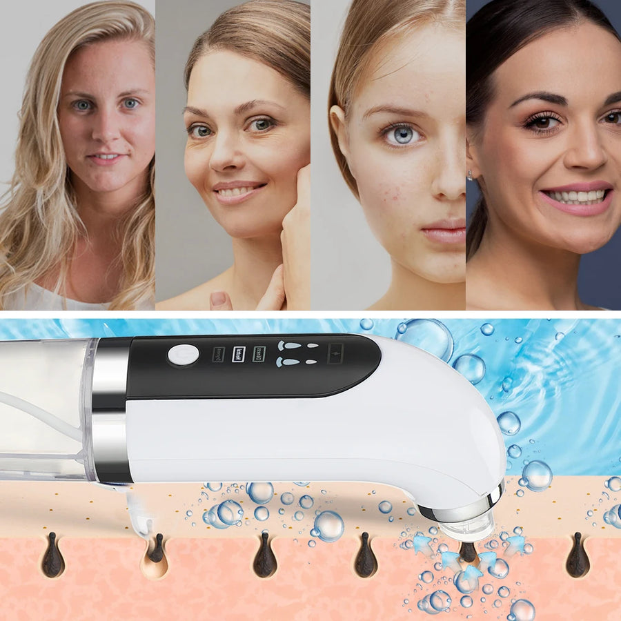 HilloNewskin - Bubble Pore Remover